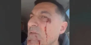 (VIDEO) Blokaderi u Crvenki pretukli čoveka nasred ulice