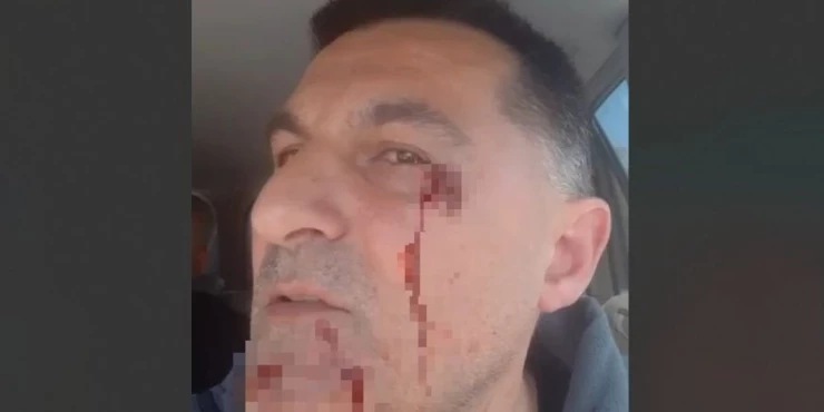 (VIDEO) Blokaderi u Crvenki pretukli čoveka nasred ulice
