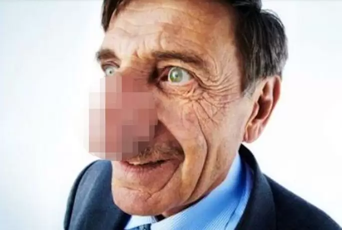 nos