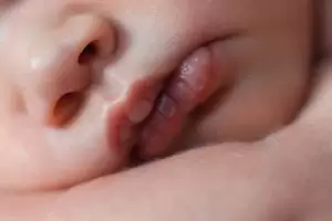 Ispucale usne bebe